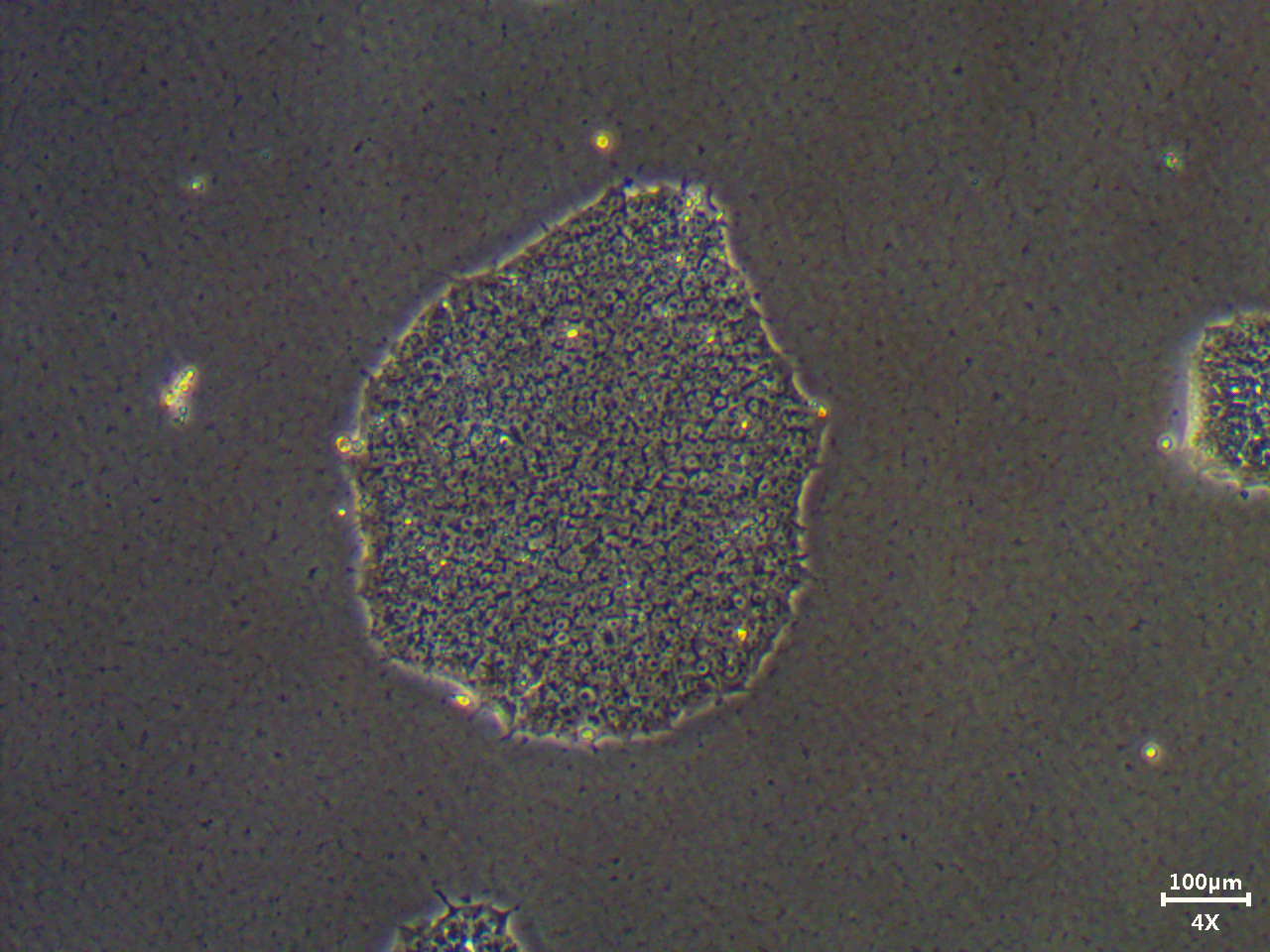 诱导多功能干细胞系（iPSCs）制备